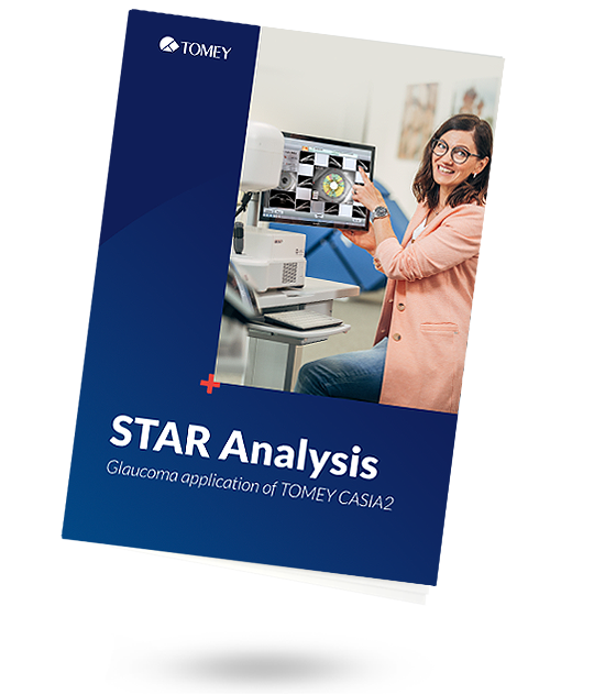 CASIA2 star analysis