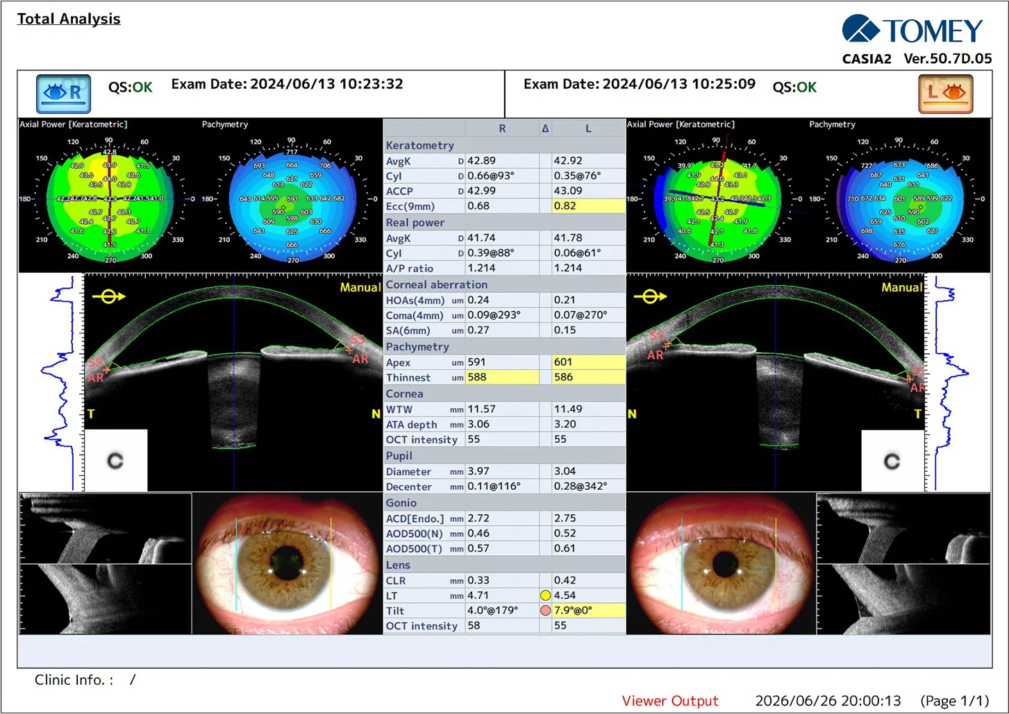 Preoperative Total Analysis