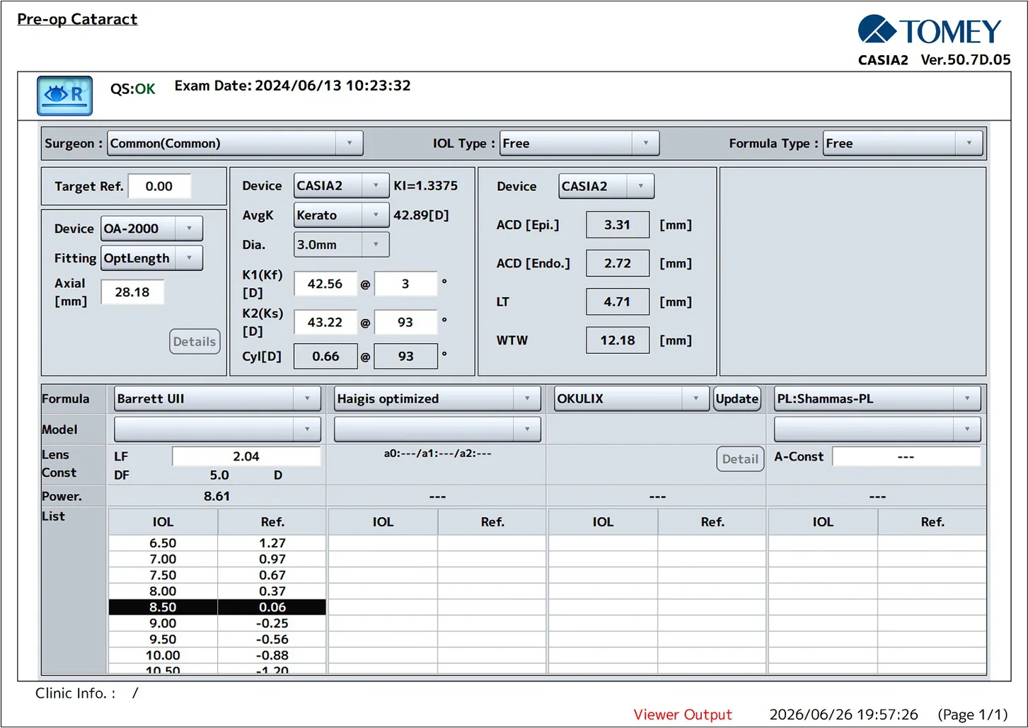 Preoperative Cataract Planning and IOL Calculation