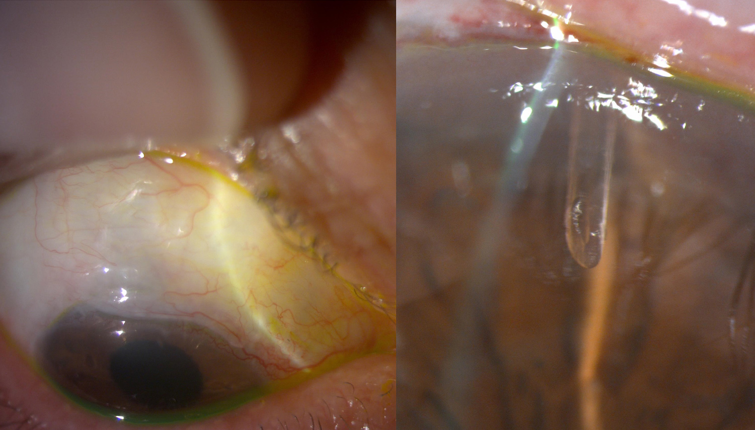 Anterior segment images
