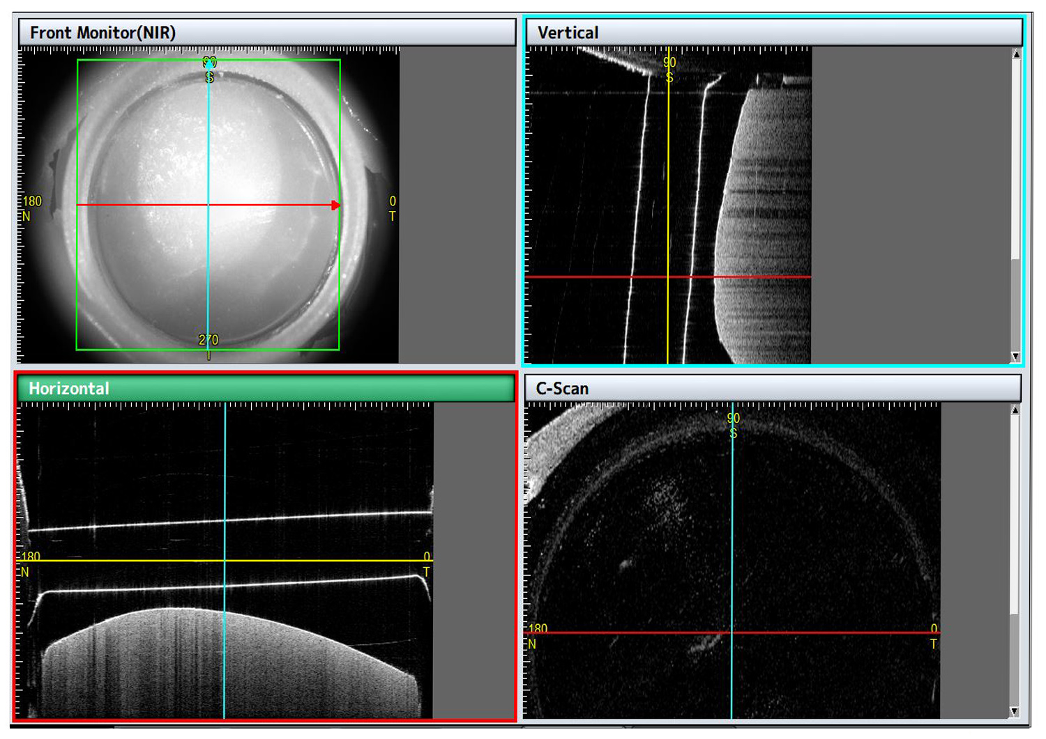 apEye: Artificial prosthetic eyes
