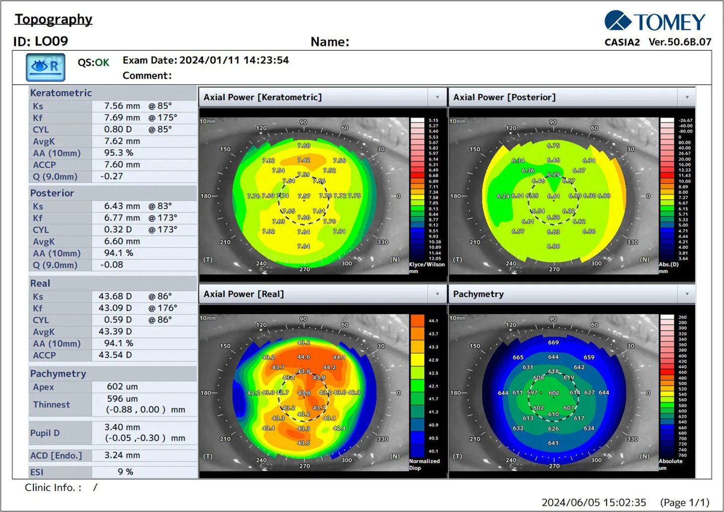 Postoperative topography