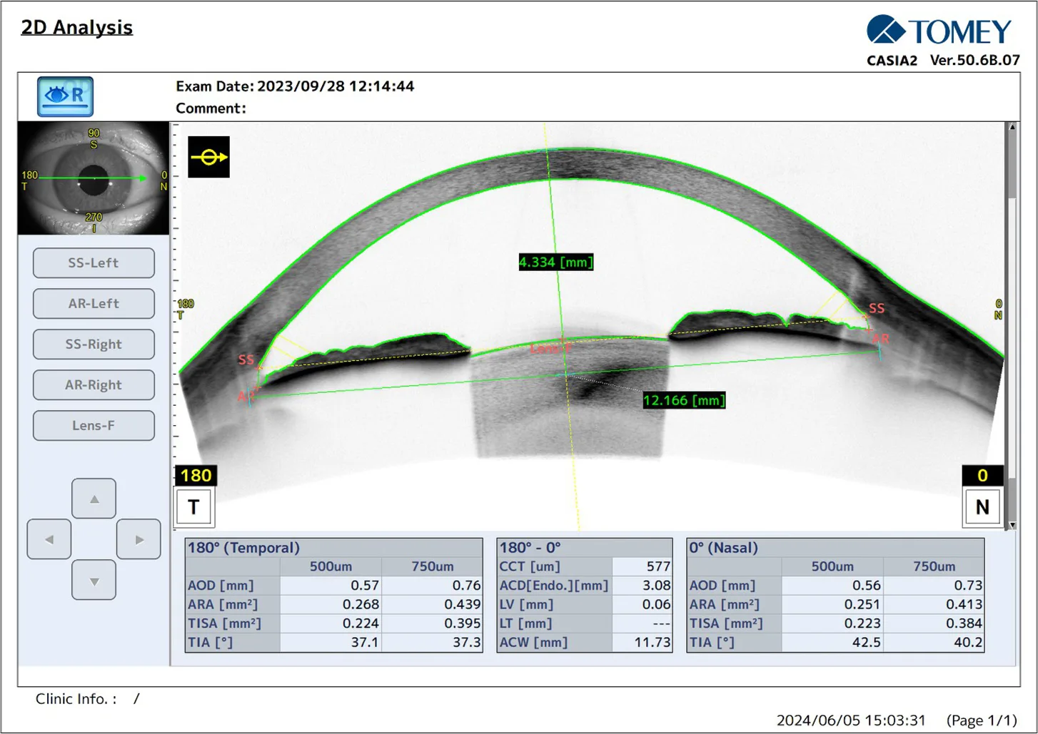 Preoperative 2D analysis