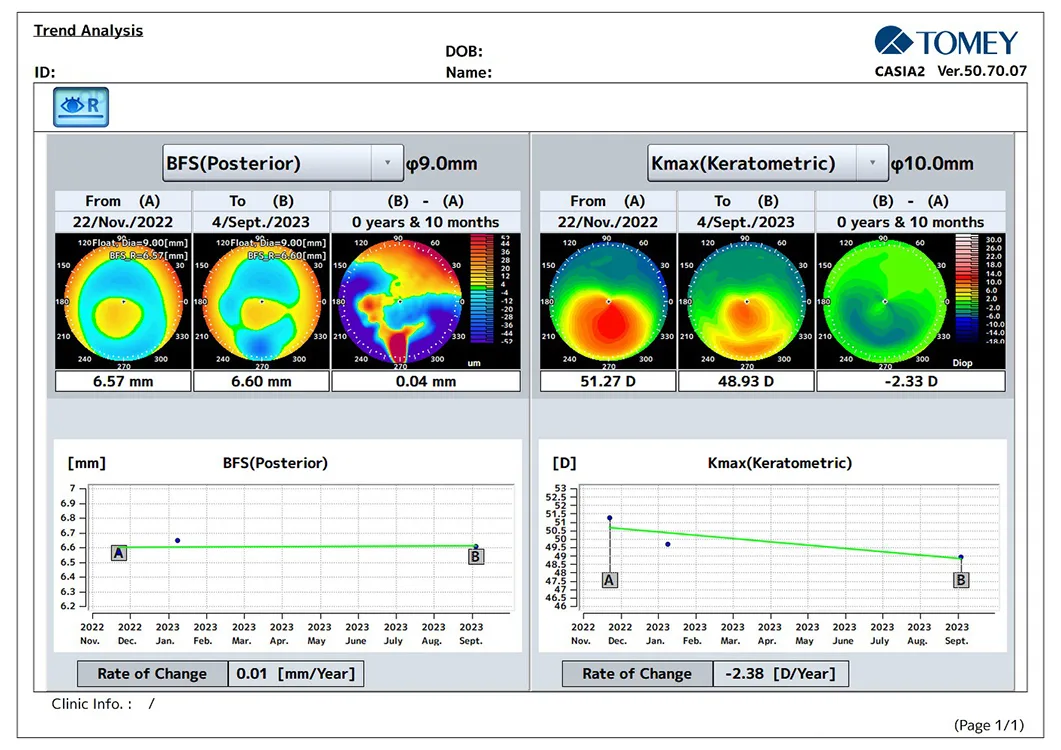 Asymmetric Ring Implantation in Keratoconus