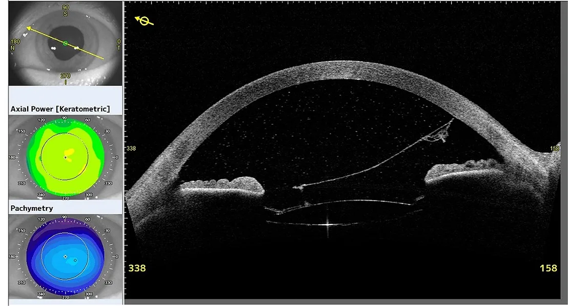 Figure 1: Day 1 assessment