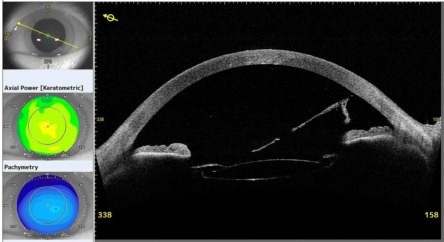 Figure 2: Day 3 assessment