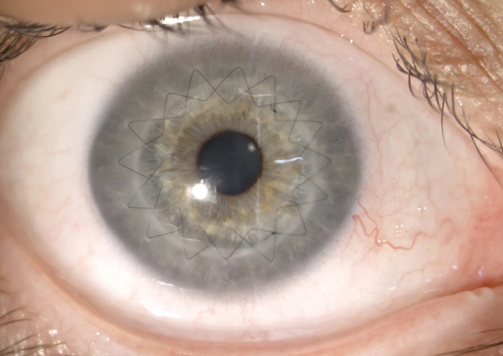 Figure 6